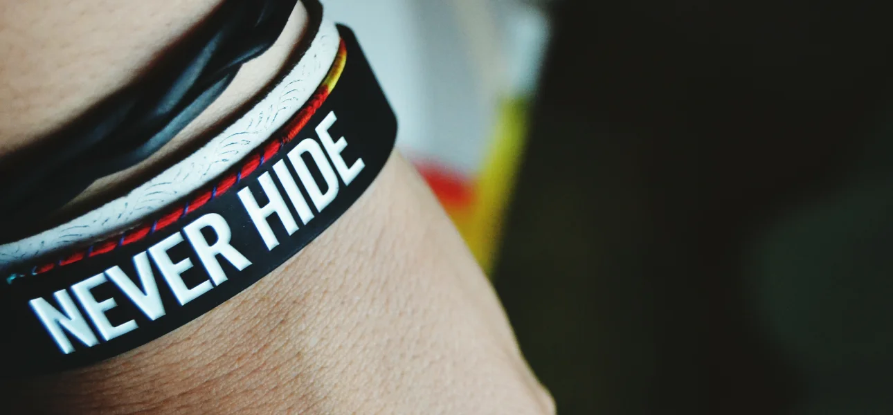 Pulsera de silicona grabada con el texto 'Nunca esconder'.